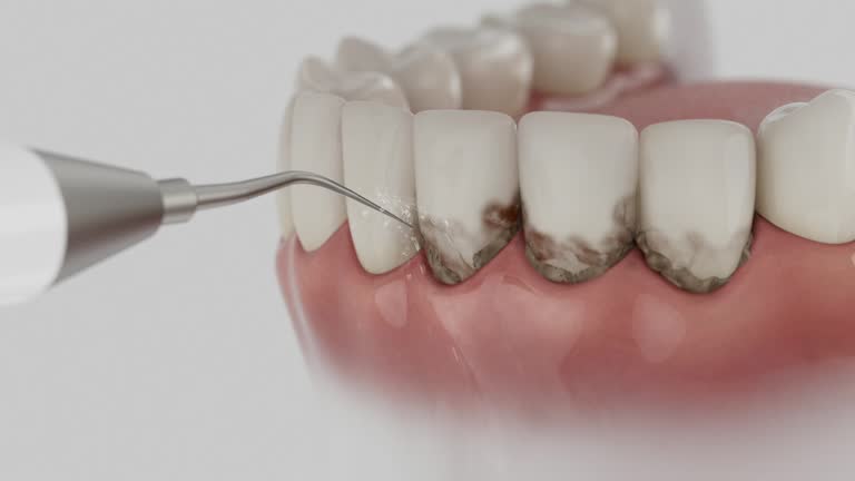 Trusted Dental Crowns And Bridges service in Hudson, PA - Dentist Open Now